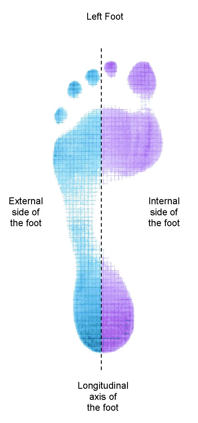 Mortons Neuroma Solution